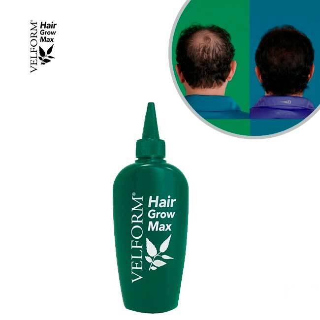 Hair Grow Max - Crecepelo natural - Ailoshop 